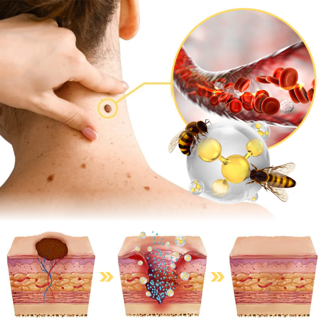بخاخ سم النحل السحري: الحل الثوري لبشرة نقية وثقة لا تُضاهى!